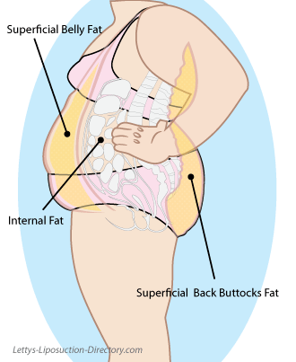 Superficial fat illustration...